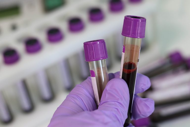 Cómo averiguar cuál es mi tipo de sangre con mi RUT